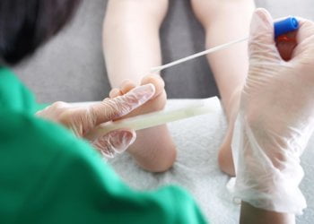 Early warning signs of cervical cancer 2