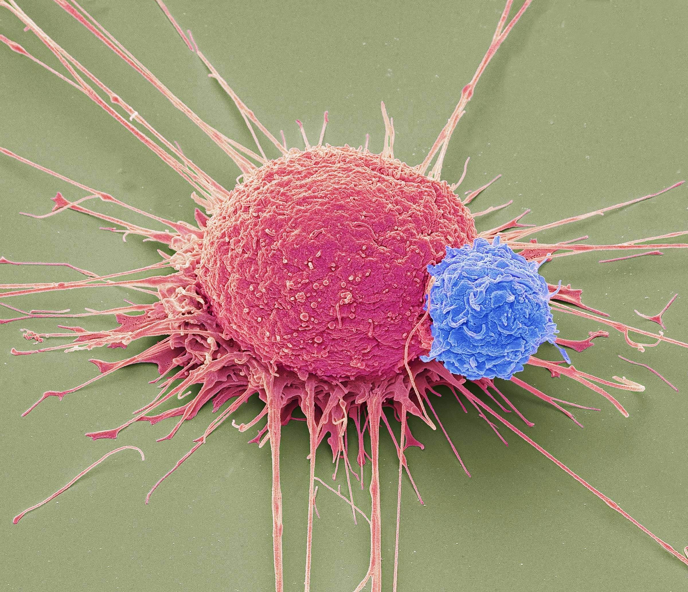 Which cancers acquire the least investment 3